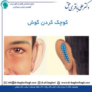 کوچک کردن گوش
